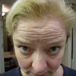 Wrinkly Forehead Sept. 30